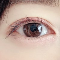 二重まぶた