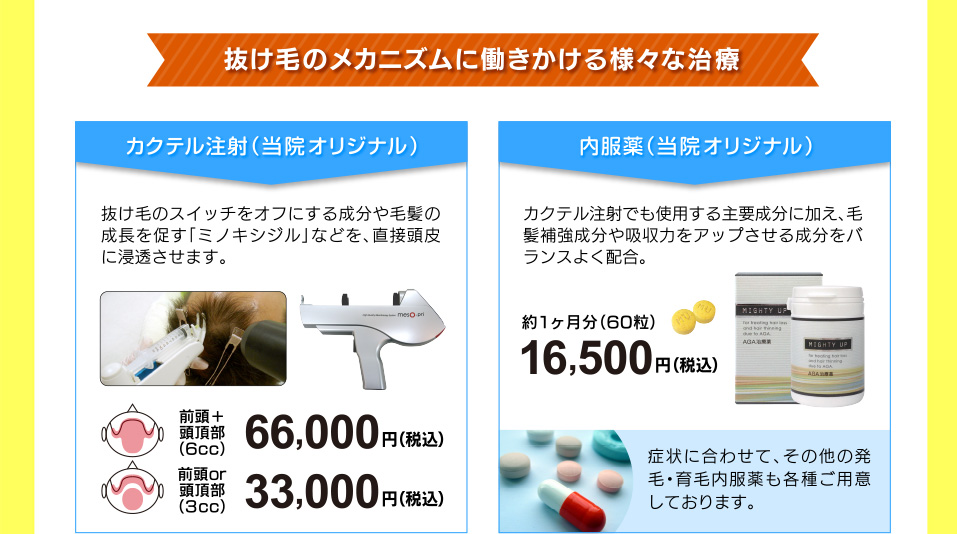 AGA（男性型脱毛症）とは・・・