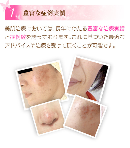 豊富な症例実績