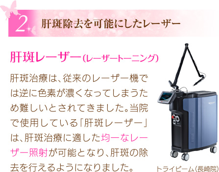 肝斑除去を可能にしたレーザー
