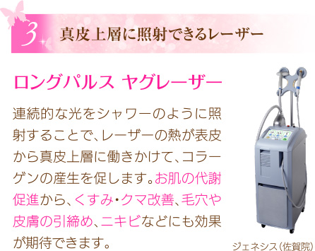 真皮上層に照射できるレーザー