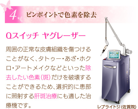 ピンポイントで色素を除去