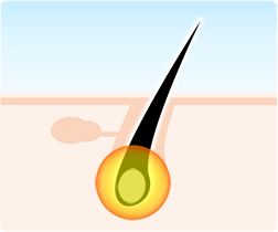 医療脱毛の仕組み