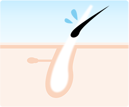 医療脱毛の仕組み