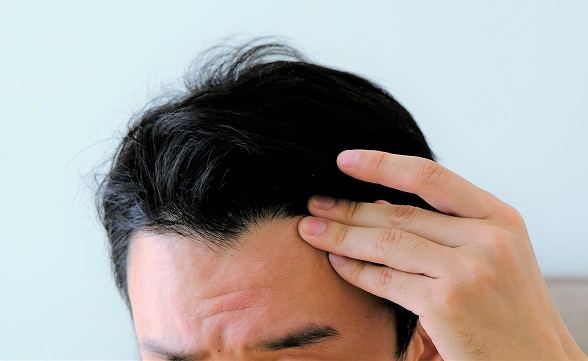AGAによる薄毛が気になり髪に触れる男性