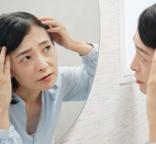 長崎でFAGA・薄毛治療を検討する50代女性