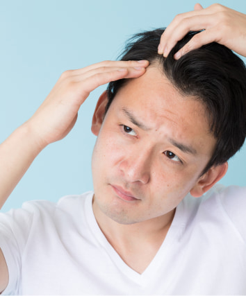 佐賀でAGA・薄毛治療を検討する男性