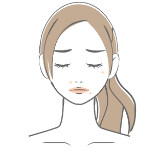 にきび・ニキビ痕が気になる肌のイメージ