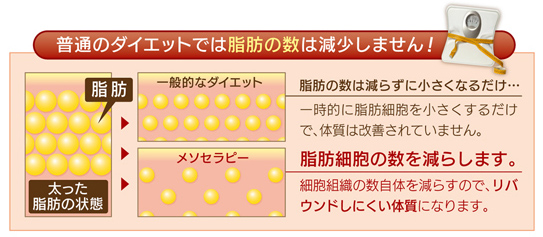 普通のダイエットでは脂肪の数は減少しません!
左側:太った脂肪の状態の図
右側上:一般的なダイエット後の状態
脂肪の数は減らずに小さくなるだけ…
一時的に脂肪細胞を小さくするだけで、体質は改善されません
右側下:メソセラピー
脂肪細胞の数を減らします。細胞組織の数自体を減らすので、リバウンドしにくい体質になります。